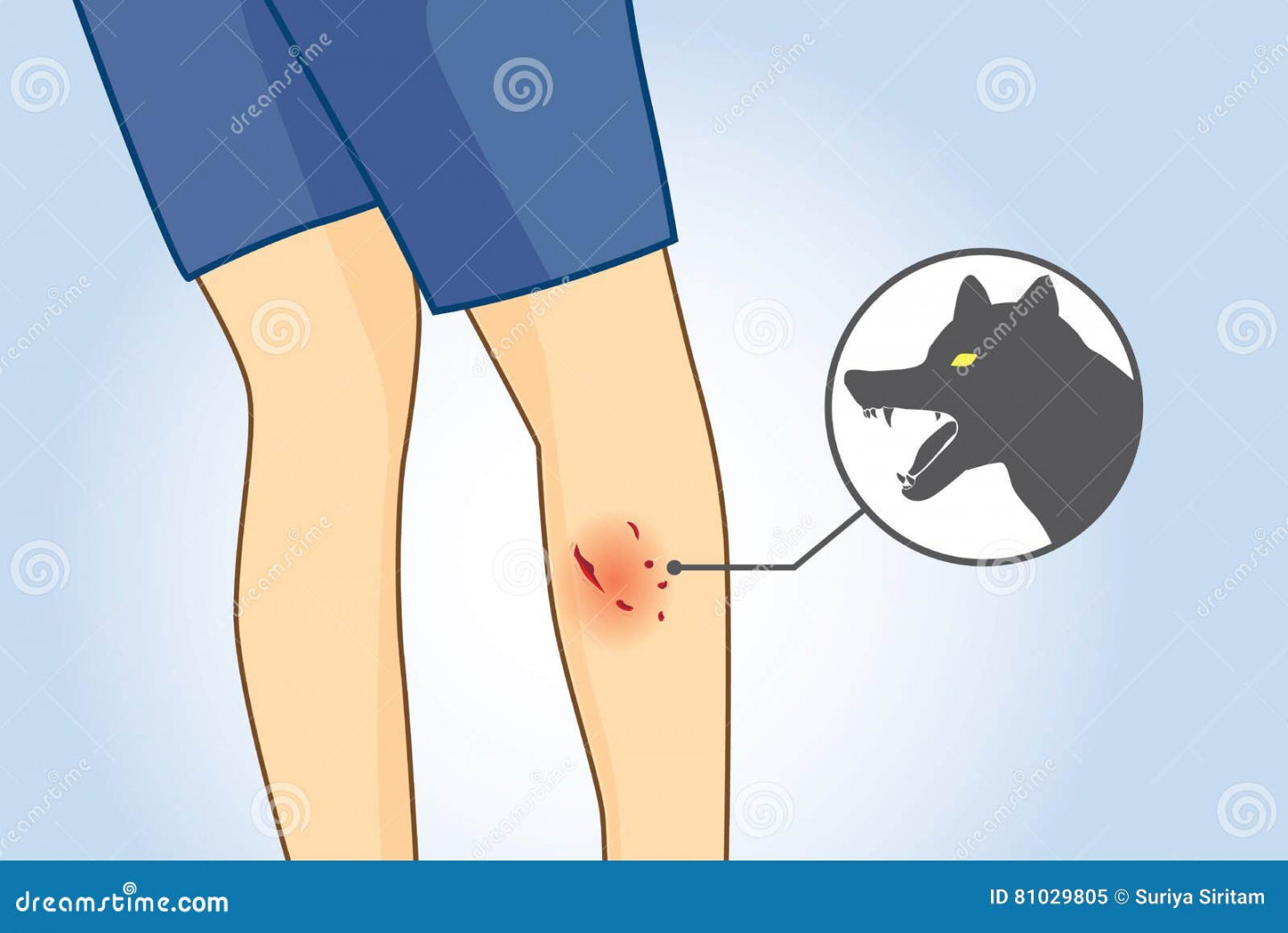 Dog Bite Stock Illustrations – , Dog Bite Stock Illustrations